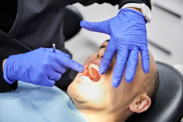 Best Emergency Gum Pain Relief  in Delshire, OH
